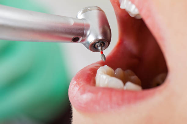 Best Same-Day Emergency Dental Services in Inesville, GA